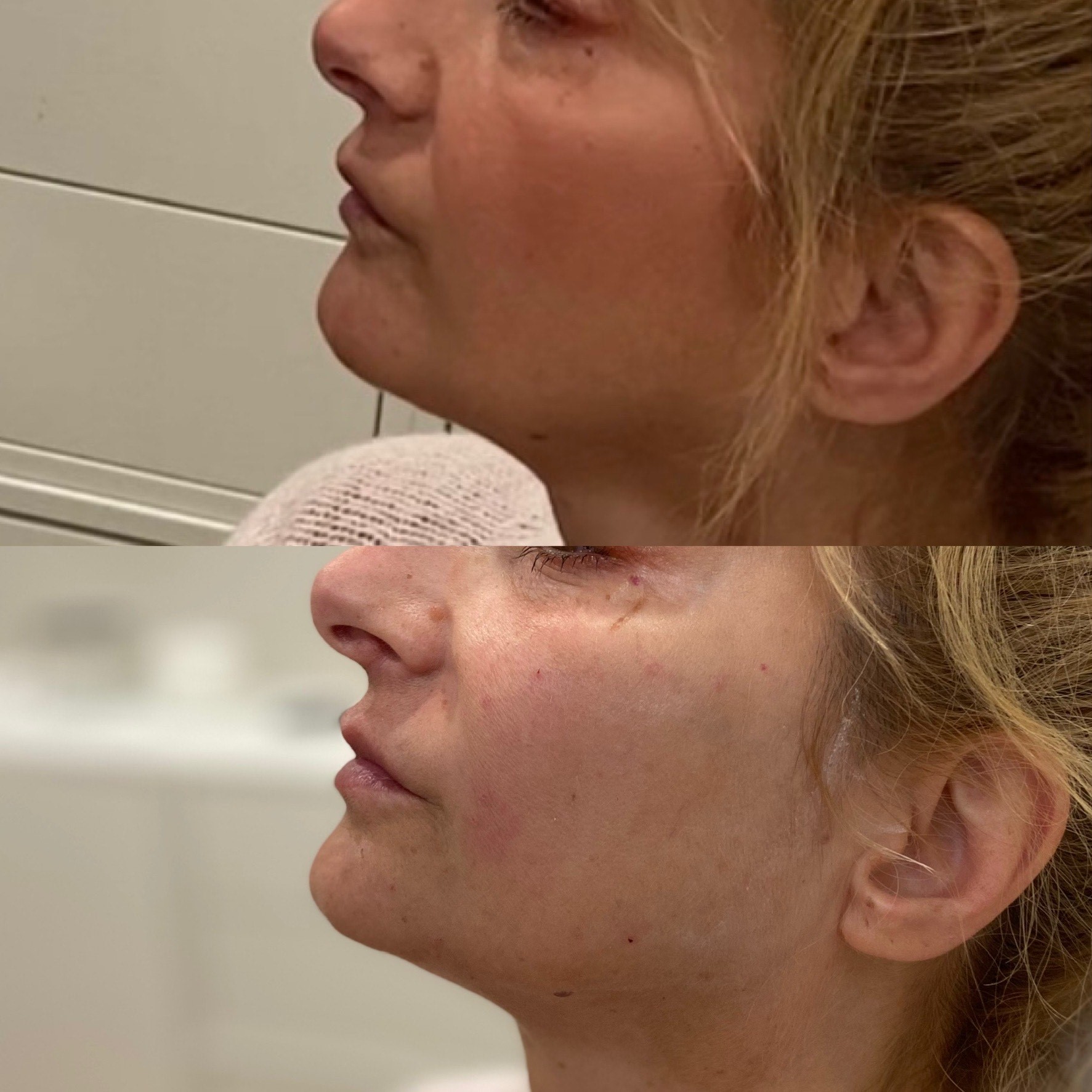 Collective Beauty Dermal After